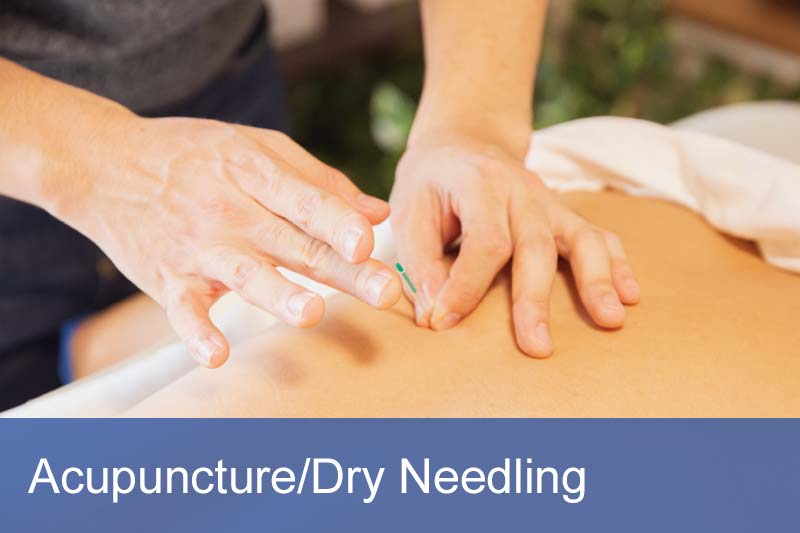 Lucks Yard Clinic - Acupuncture and Dry Needling
