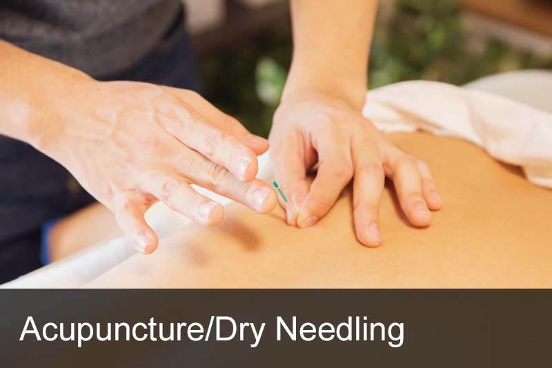 Lucks Yard Clinic - Acupuncture and Dry Needling