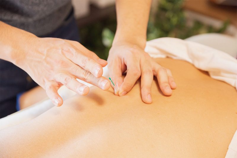 Lucks Yard Clinic, Near Elstead, Surrey - Acupuncture & Dry Needling